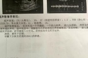 怀孕建档电脑信息录入错误的影响及解决方法（怀孕建档信息录入错误的危害与防范）